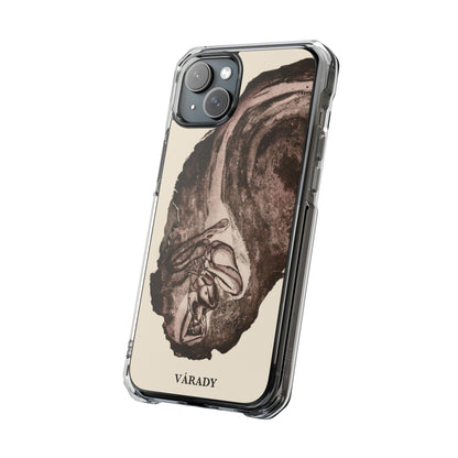Entwined | Magnetic Clear Impact Cases